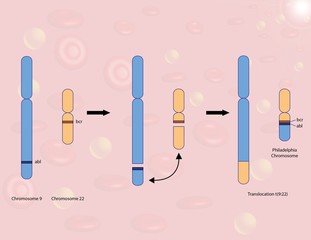 Philadelphia chromosome