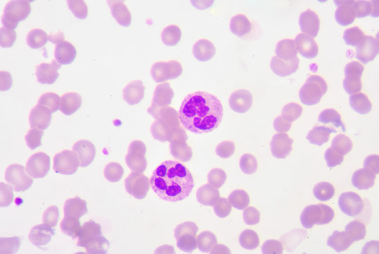 neutrophil on blood smear © toeytoey