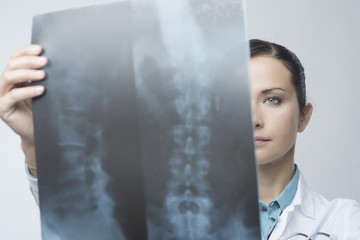 Female radiologist checking x-ray image