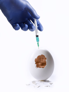 Abortion
