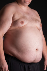 Naklejka premium An obese young man