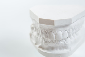 Gypsum model of human jaw on a white background.
