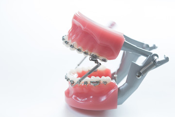 Dental lower jaw bracket braces model on white