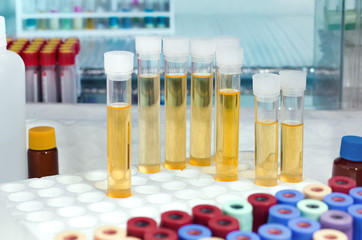 analysis of urine tubes in lab