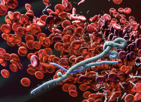 Ebola virus in blood