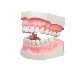 Dentoform, Dental teeth model