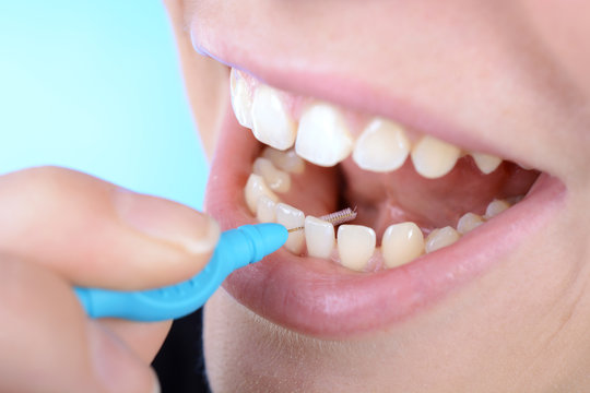 Zahnpflege der Zahnzwischenräume