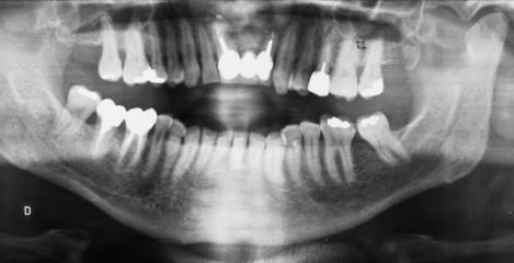 radiographie panoramique dentaire © Unclesam