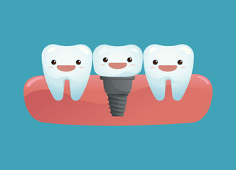 Tooth implant © SIMPILI