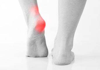 Woman's legs, heel and ankle pain