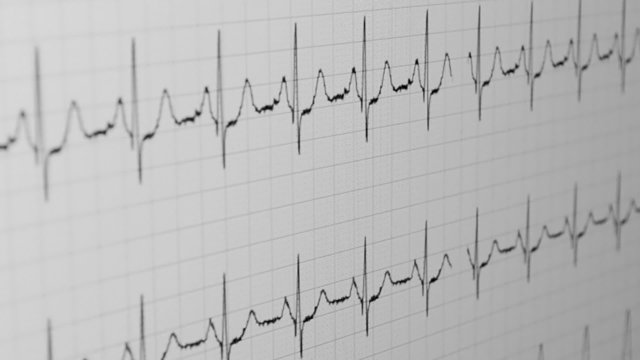 medical pulse, cardio diagram, healthcare