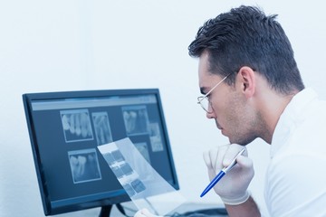 Fototapeta na wymiar Male dentist looking at x-ray