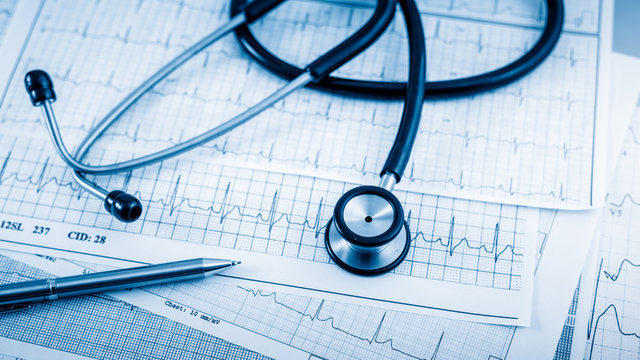 Stethoscope on cardiogram concept for heart care