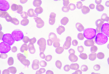 Myeloblast