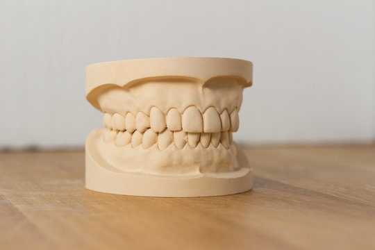 Dental Mold Showing A Full Set Of Teeth