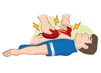 First Aid resuscitation (CPR) using defibrillator - obrazy, fototapety, plakaty