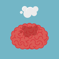 Brain concept illustration