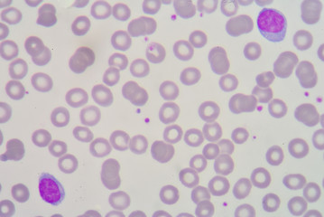 lymphocyte