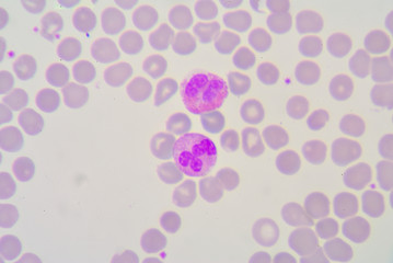 segmented neutrophils