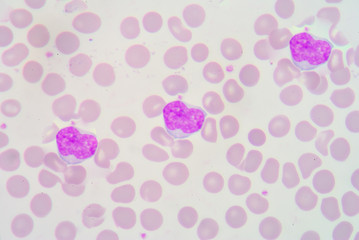 lymphocyte