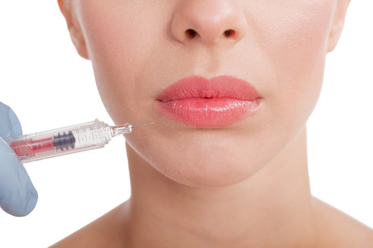 close up botox shot in the female lips