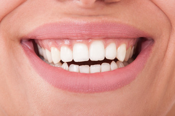 Close-up of perfect female teeth smiling
