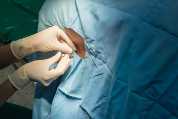anesthesiologist do spinal block for patient