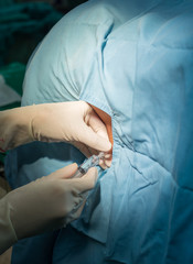 anesthesiologist do spinal block for patient