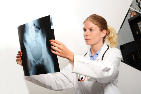 Female doctor examining an x-ray image