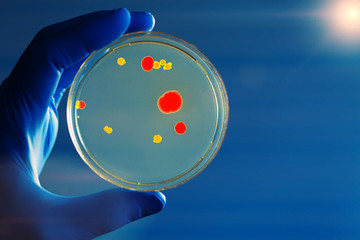 petri dish in hand