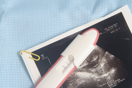 Pregnancy Test Pack At Blue Background