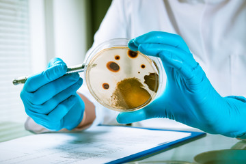 Agarplatte besiedelt mit Bakterien im Labor