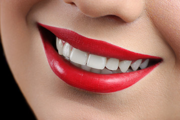 Obraz premium smile, teeth whitening