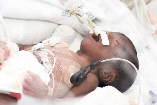 Newborn baby inside incubator