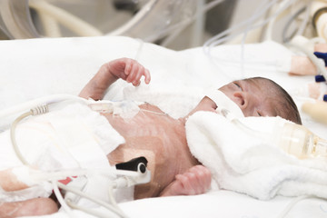 Newborn baby inside incubator