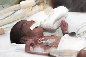 Portrait of newborn baby sleeping inside incubator - obrazy, fototapety, plakaty