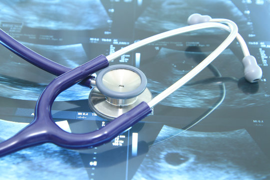 Close up image of stethoscope on x-ray film