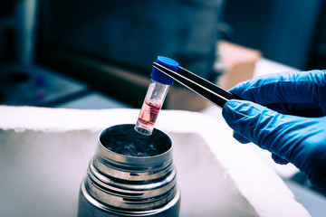 Liquid Nitrogen bank containing suspension of stem cells.