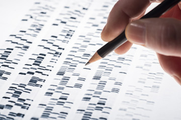 Auswertung von DNA-Gel - obrazy, fototapety, plakaty