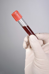 Hand holding blood in test tube on gray background