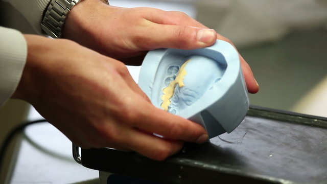 dentist teeth up by special equipment
