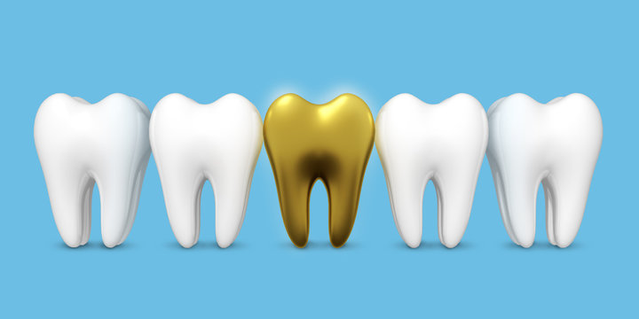 Zahn Gold Krone blau