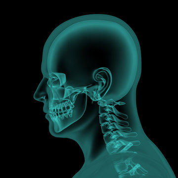 Head and neck x-ray scan