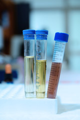 Scientist doing chemical test  take with blue filter