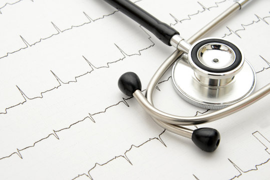 医療イメージ―聴診器と心電図