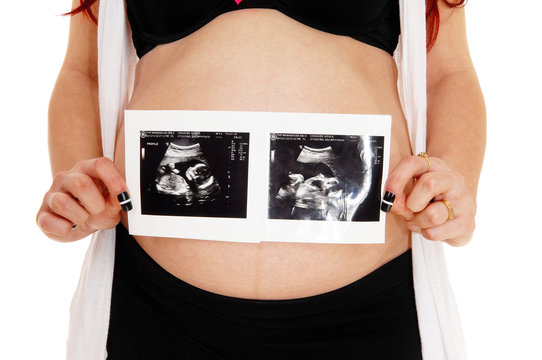 Pregnant women with ultrasound picture.