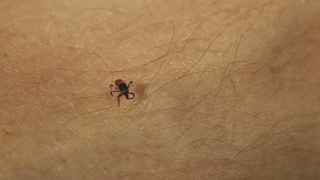 Tick - parasitic arachnid blood-sucking carrier of diseases