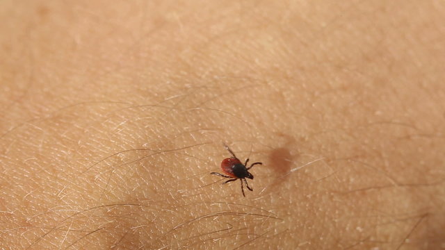Tick - parasitic arachnid blood-sucking carrier of diseases
