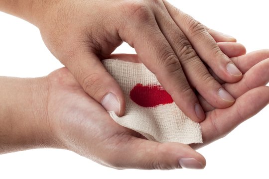 person holding medical bandage on bleeding palm
