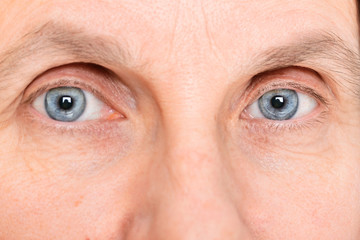 Closeup of adult woman eyes wearing soft contact lenses